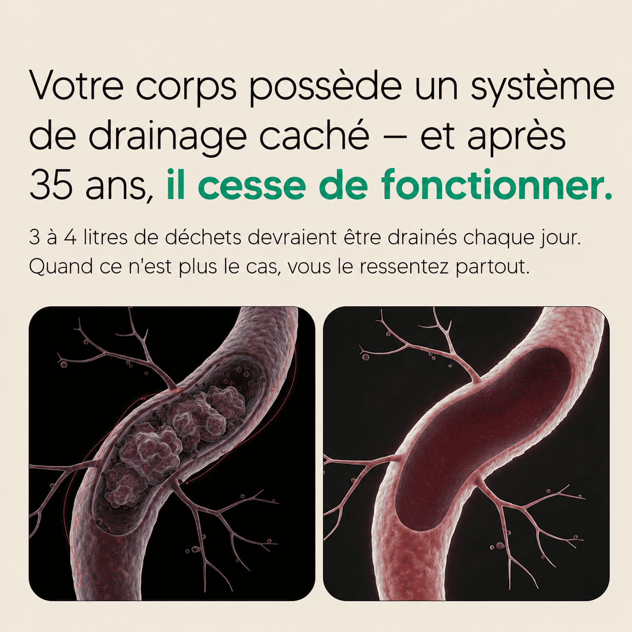 Nervia™ - Gélules de Drainage Lymphatique · Transformation totale en 60 jours
