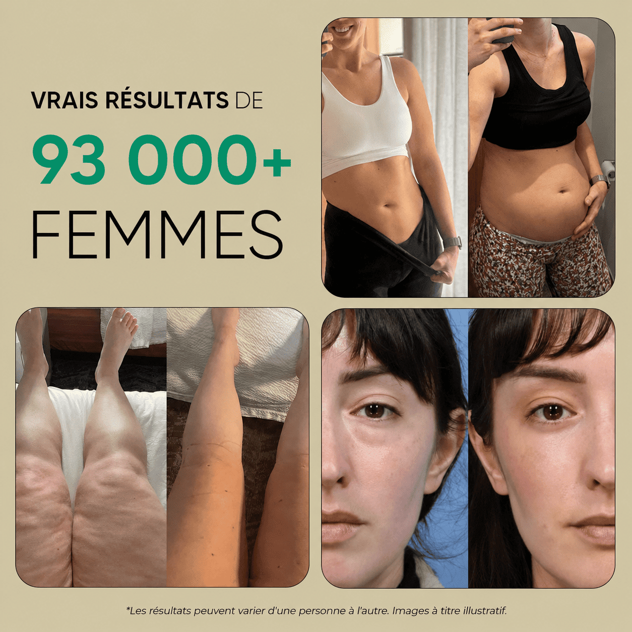 Nervia™ — Gélules de Drainage Lymphatique · Transformation totale en 60 jours !