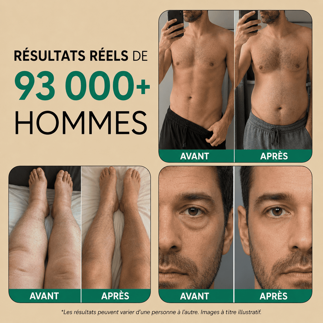 Nervia™ - Gélules de Drainage Lymphatique · Transformation totale en 60 jours